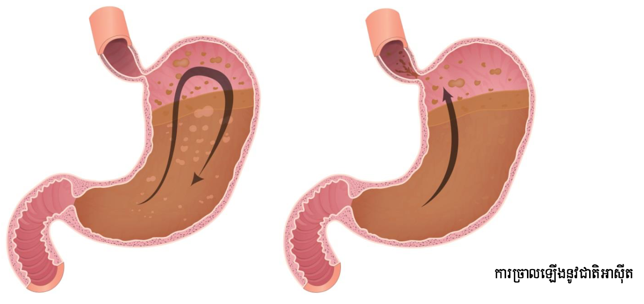 5- digestive kh 2-1