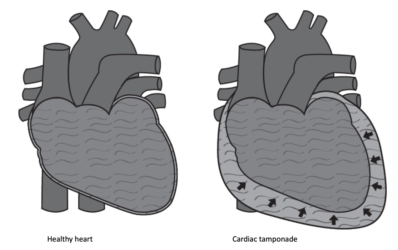 1- cardio 5-2