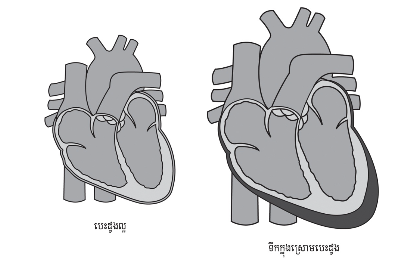 1- cardio kh 5-1