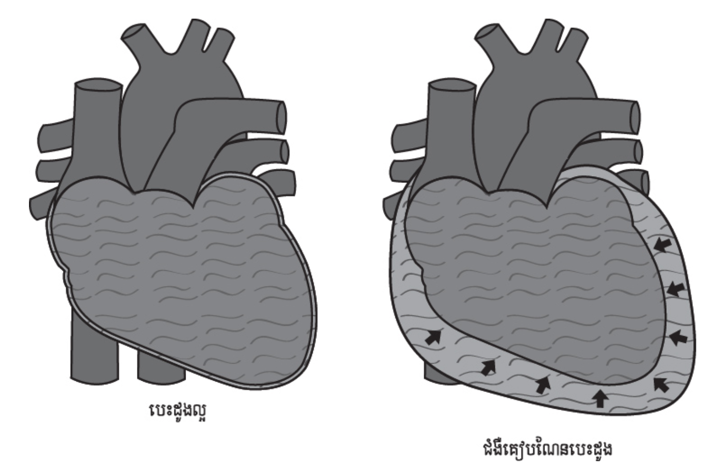 1- cardio kh 5-2